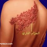 أسباب الحزام الناري 5 أسباب تؤدي الى ظهور مرض الحزام الناري 4