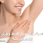 أسباب اسمرار الإبط وطرق التخلص منه 3